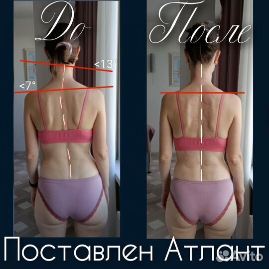 Восстанавливающий массаж