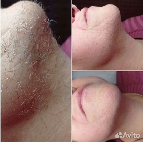 Шугаринг сахарное моделирование