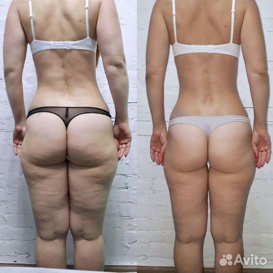 Массаж для здоровья и красоты