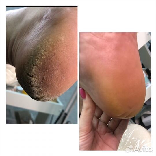 Маникюр/педикюр женский/мужской