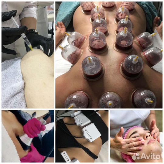 Массаж лица и тела, LPG вакуум, банки