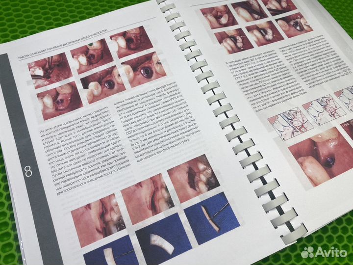 Пластическая хирургия мягких тканей. Зуккелли