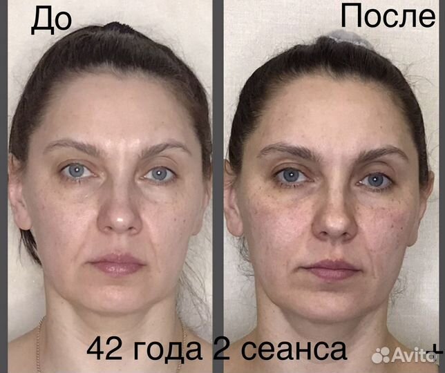 Детский массаж