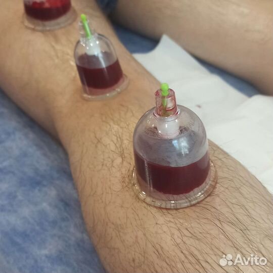 Массаж оздоровительный