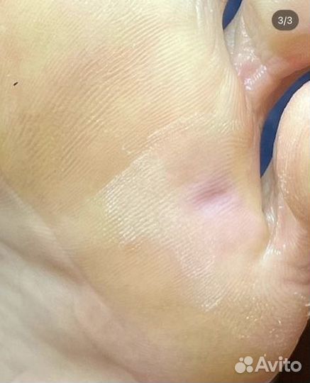 Услуги подолога