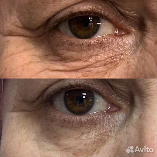 Холодная плазма