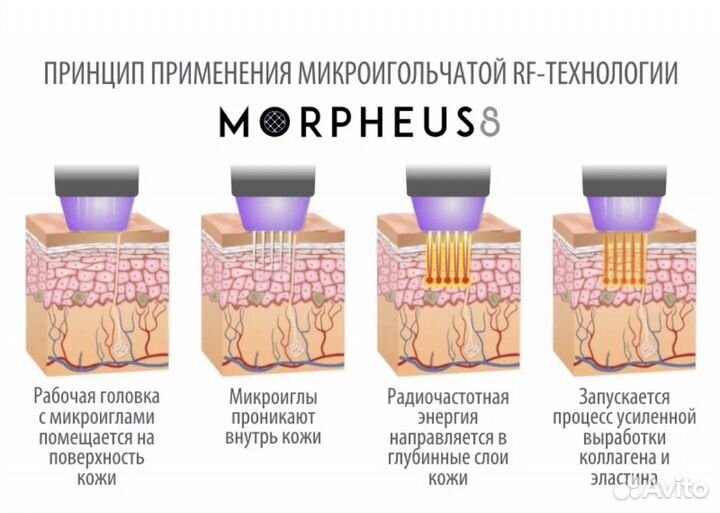 Morpheus 8 RF lifting #1 в мире