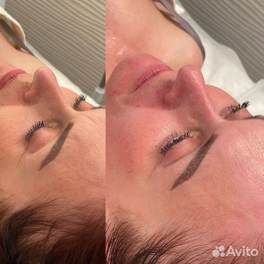 Массаж лица. Скульптурно-букальный,глубокотканный