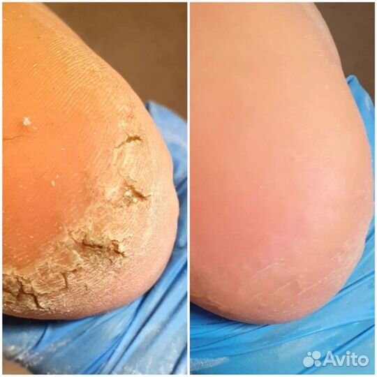 Маникюр с покрытием гель-лаком