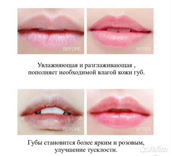 Увлажняющие гидрогелевые патчи для губ