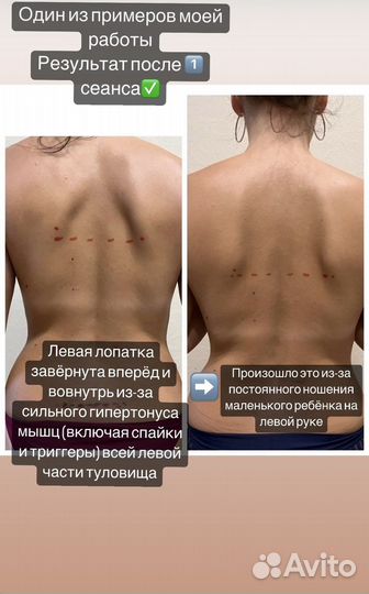 Массаж (миопрессура, мaнyaльный массаж, триггеры)