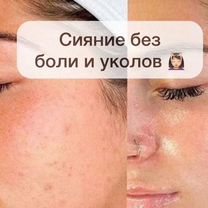 Косметолог. Чистка лица. Пилинг. Уход, Москва