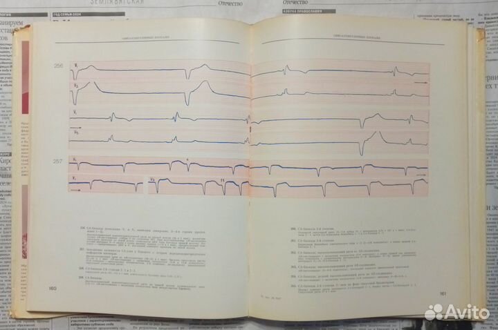 Атлас электрокардиограмм