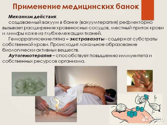 Банки для спины 10шт. в упаковке