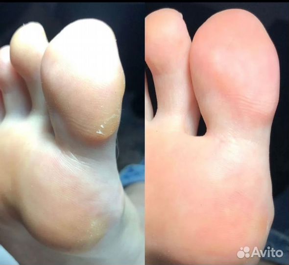 Педикюр с покрытием гель-лак (все включено)