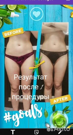 Программа плоский живот