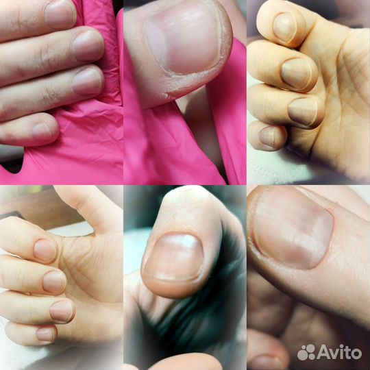 Дизайн ногтей