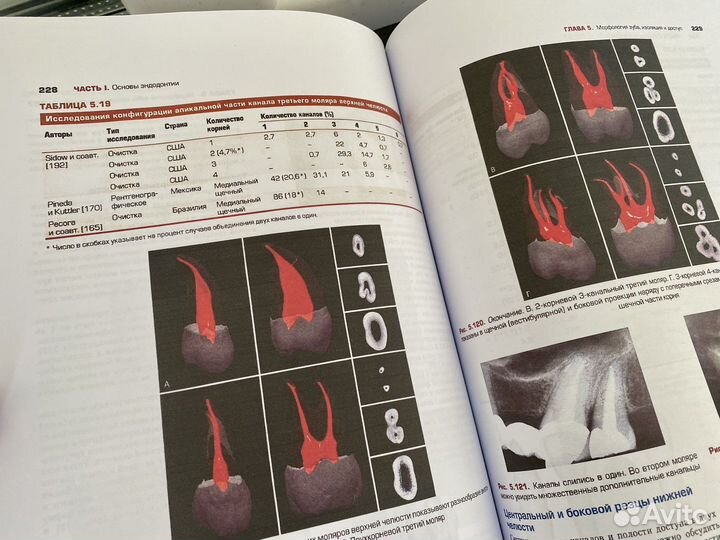Эндодонтия коэн