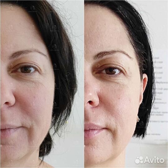 Массаж и чистка лица