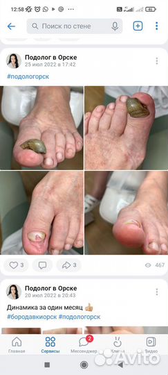 Педикюр на дому