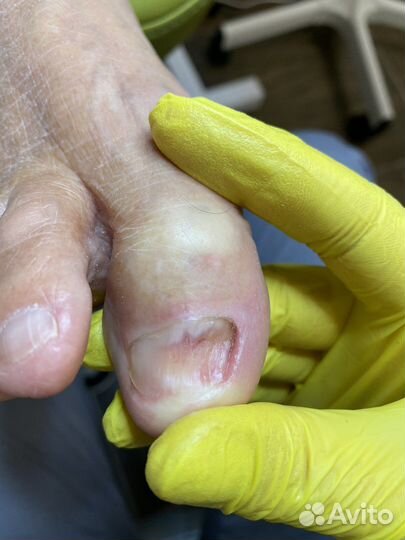 Подолог педикюр подология