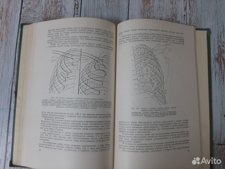Кости и суставы в рентгеновском изображении. 1952