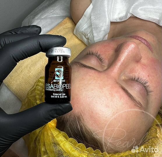 Косметолог, чистка лица, подбор домашнего ухода