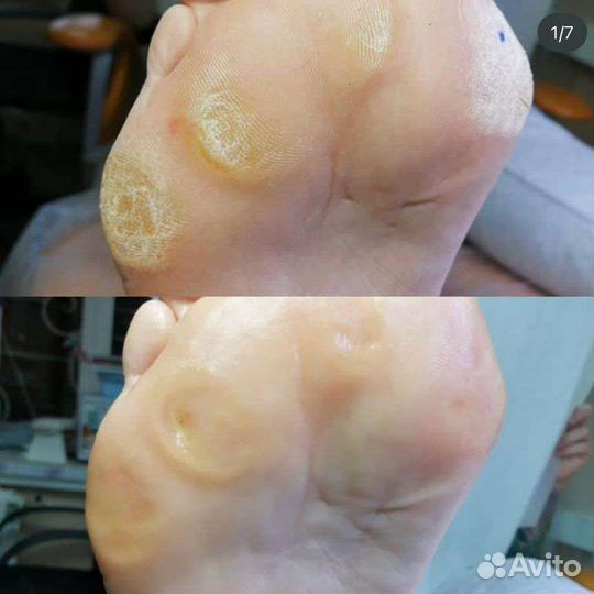 Подолог Педикюр Маникюр