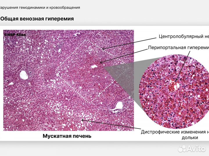 Репетитор по гистологии/патологической анатомии