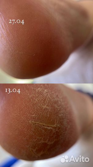 Топ мастер маникюра подолог