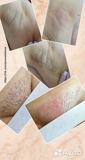 Восковая депиляция