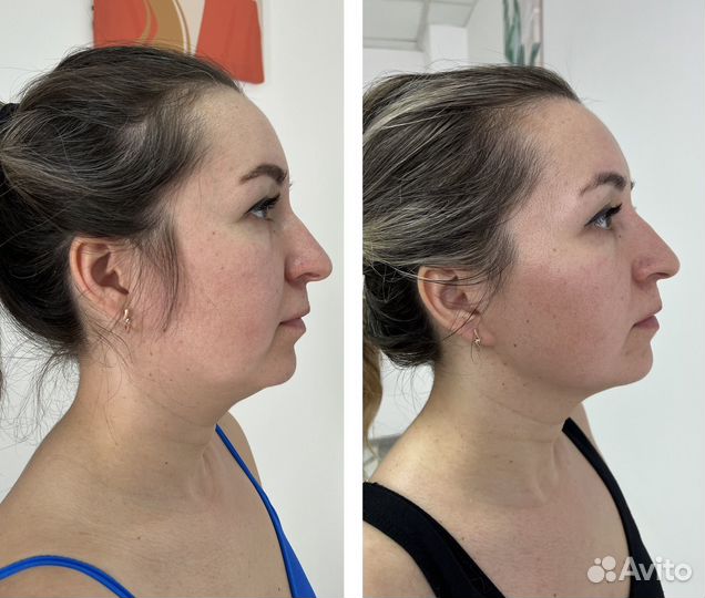 Массаж ручной / Массаж аппаратный / Косметология