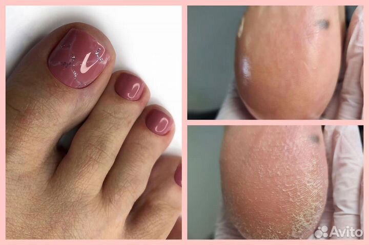 Маникюр и педикюр