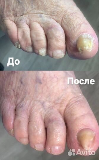 Маникюр и педикюр, подолог