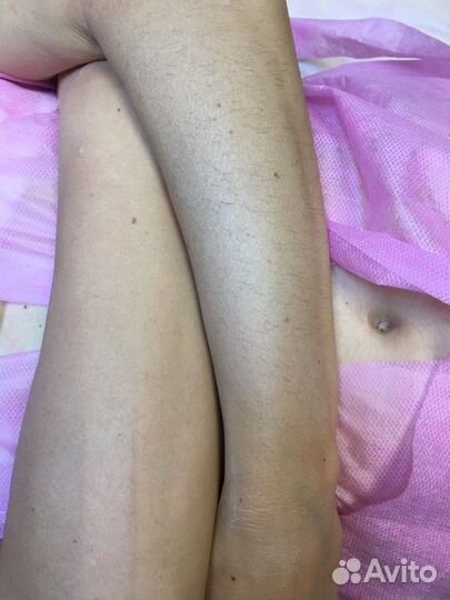 Депиляция воском: глубокое бикини