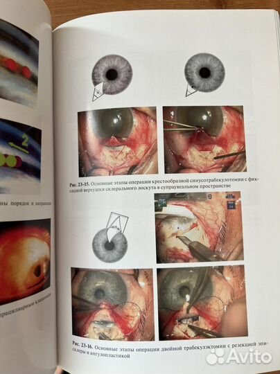 Офтальмология Национальное руководство