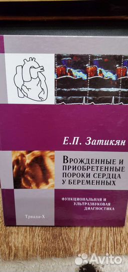 Врожденные пороки сердца у беременных. Затикян Е.П
