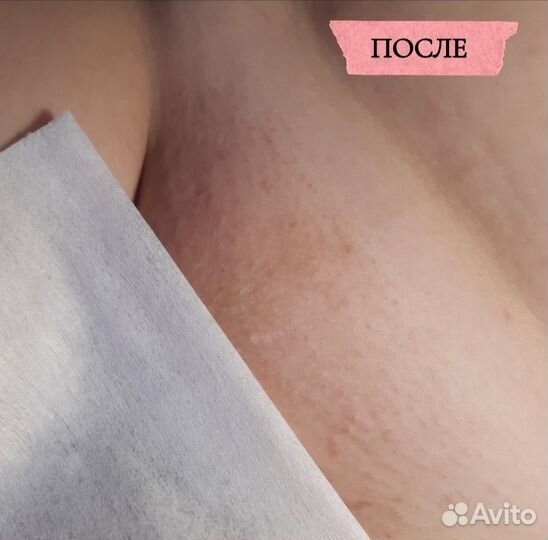 Модель на депиляцию