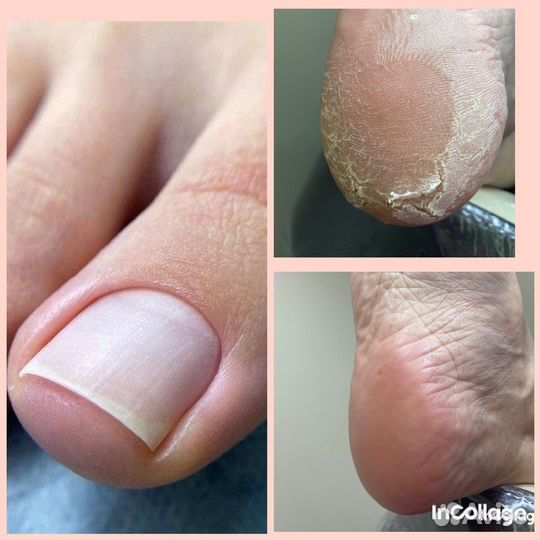 Маникюр, Смарт педикюр, наращивание ногтей Мещера