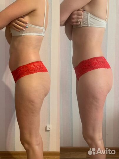 Антицеллюлитный массаж коррекция фигуры