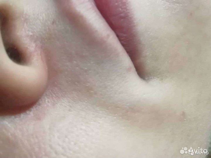 Шугаринг SPA-уход