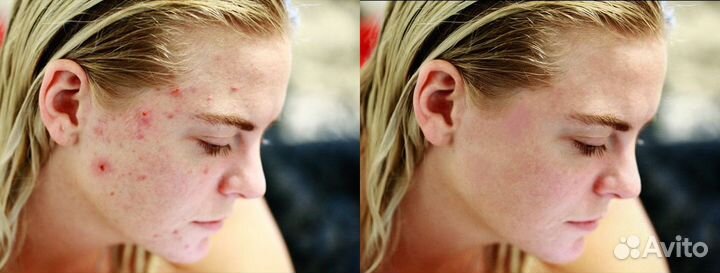 Обработка фотографий