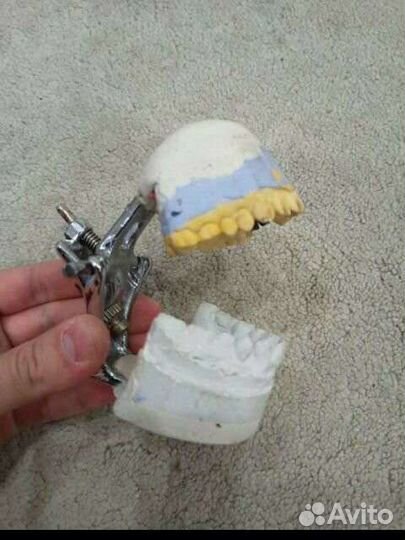 Слепок зубов челюсти из гипса