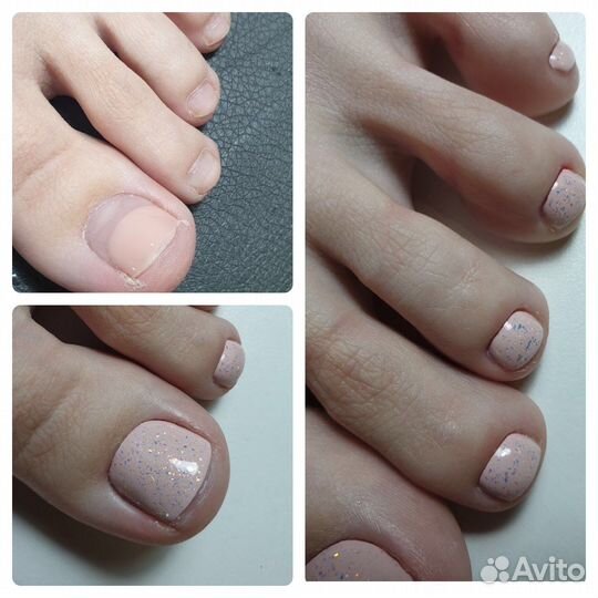 Педикюр,выезд на дом