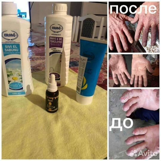 Сухость рук