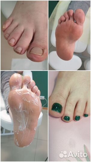 Маникюр педикюр