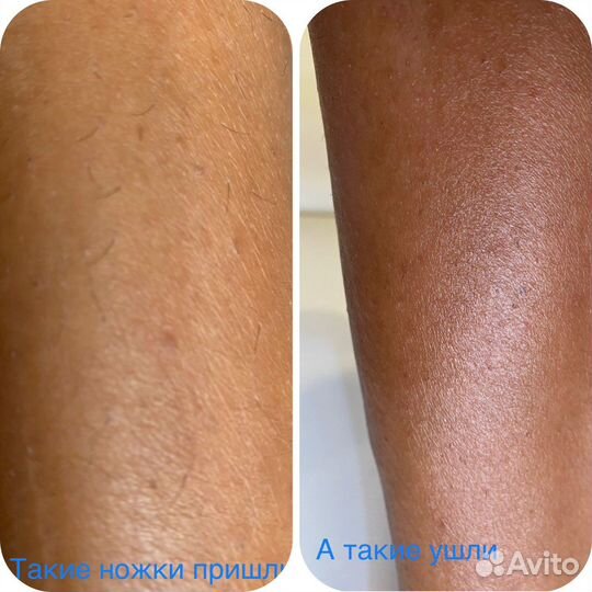 Шугаринг, Воск