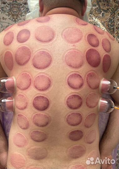 Лечебный массаж