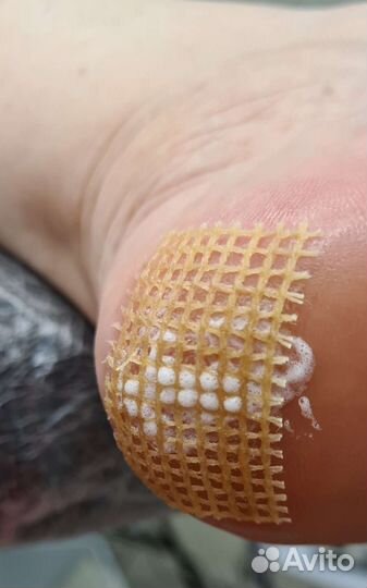 Подология И эстетика