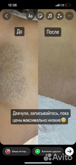 Восковая депиляция